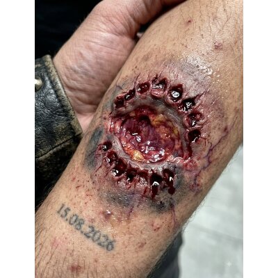 Zombie-Biss Latexwunde mit Mastix-Hautkleber – Realistische SFX Latex-Applikation, wiederverwendbare künstliche Wunde für Halloween, Zombie Kostüm, Horror Make-up, Karneval, Cosplay, Mottoparty, Theater, Film, Foto, Spezialeffekte & Maskenbildner Zubehör